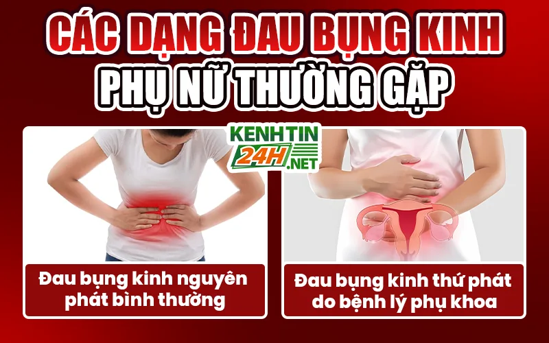 Các dạng đau bụng kinh thường gặp