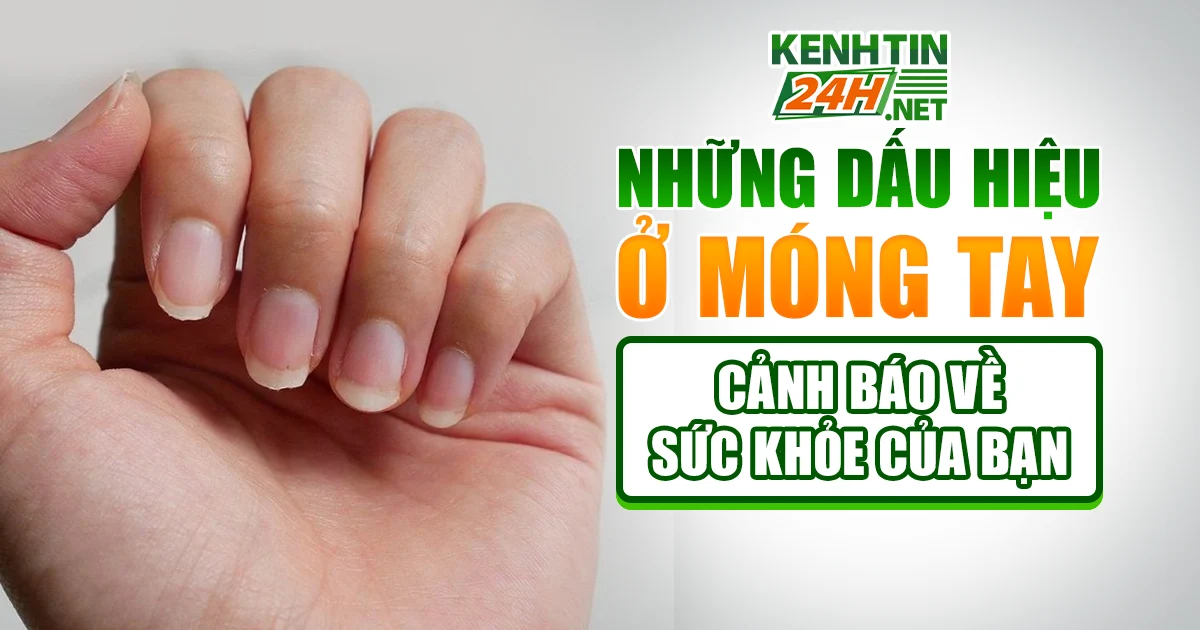 Dấu Hiệu Ở Móng Tay