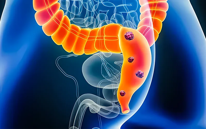 Những Biểu Hiện Và Sự Chủ Quan Của Người Bệnh