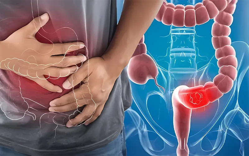 Trường Hợp Đáng Tiếc Của Một Nam Bệnh Nhân 30 Tuổi