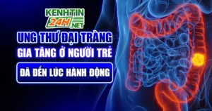 Ung Thư Đại Tràng