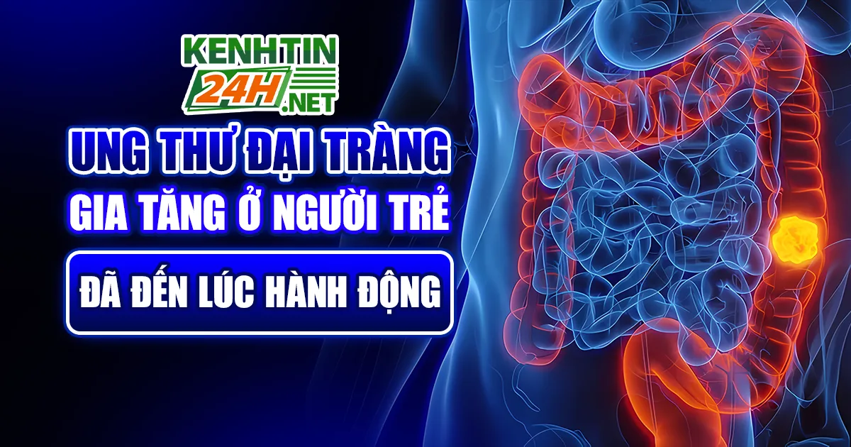 Ung Thư Đại Tràng
