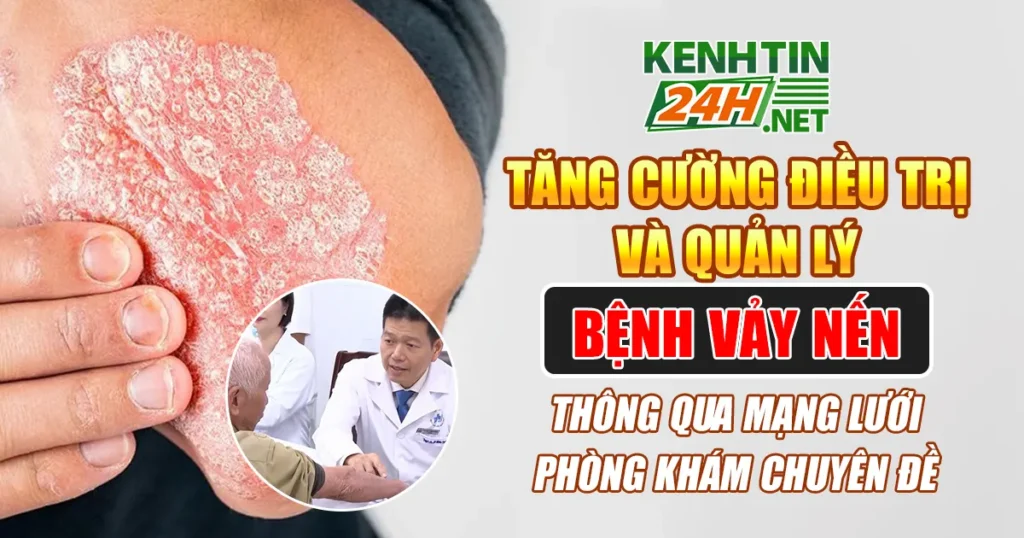 Bệnh vảy nến
