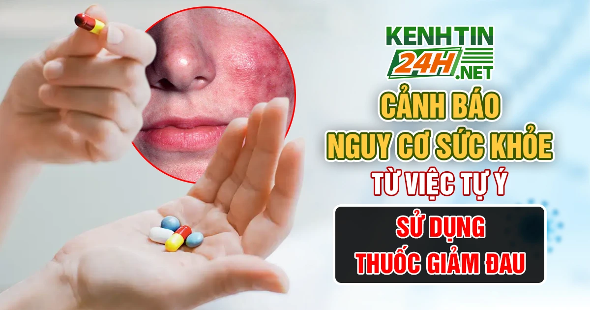 Cảnh báo nguy cơ sức khỏe từ việc tự ý sử dụng thuốc giảm đau