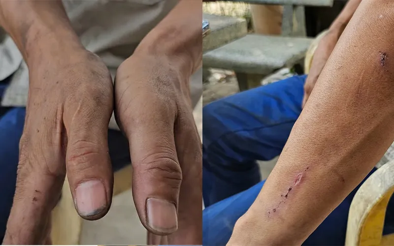 Hậu quả thương tích