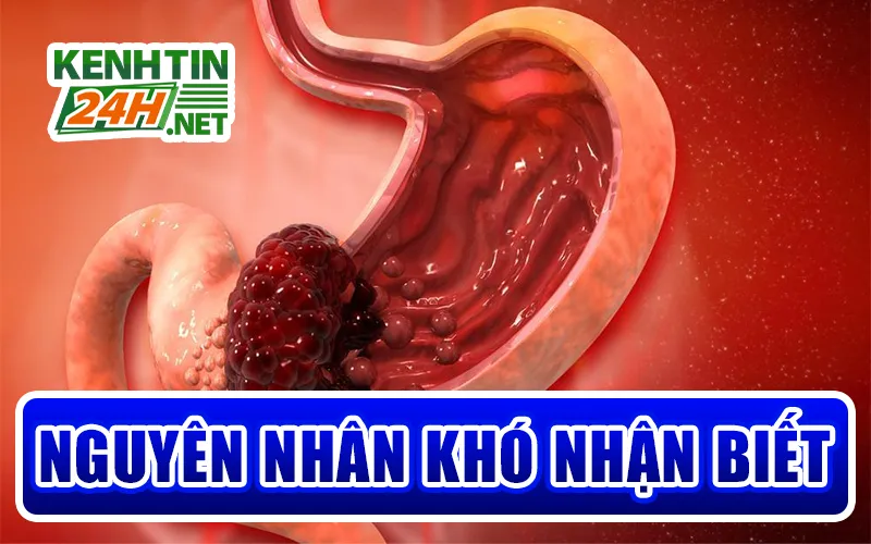 Nguyên Nhân Khó Nhận Biết