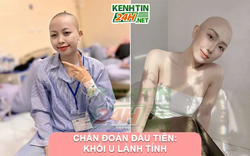 Chẩn đoán đầu tiên: Khối u lành tính
